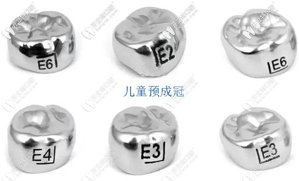 兒童預成冠示意圖 兒童預成冠示意圖