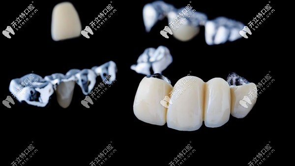 真相了,柳州市華心口腔做烤瓷和全瓷牙價格是這樣的?