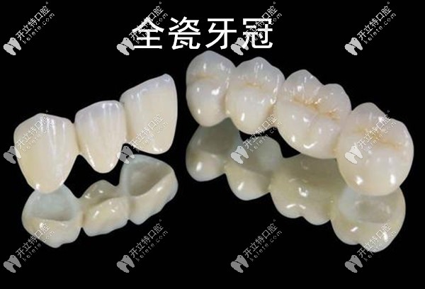 柳州華山口腔醫(yī)院的全瓷牙