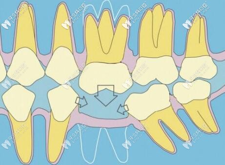 位于海港區(qū)的秦皇島藍(lán)天口腔價格無敵了,你覺得便宜嗎