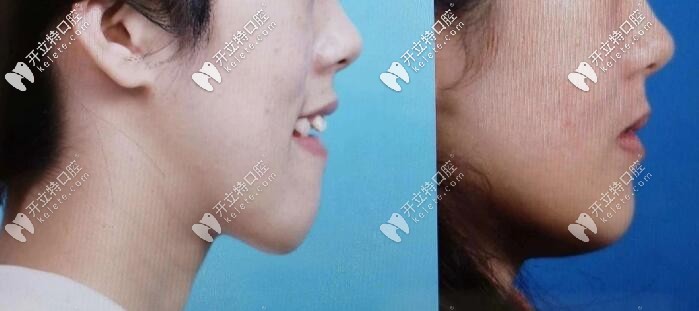 西安比較出名的牙齒矯正醫(yī)生美奧口腔馮雪收到錦旗,真棒