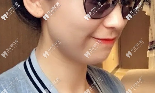 兩年的時(shí)間牙齒變化蠻大的