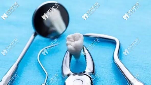 拔牙前的注意事項(xiàng)與禁忌癥,你有必要知道