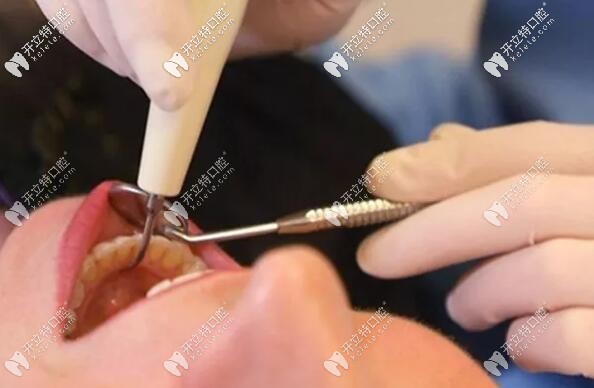 有高血壓、糖尿病等病史的能拔牙嗎