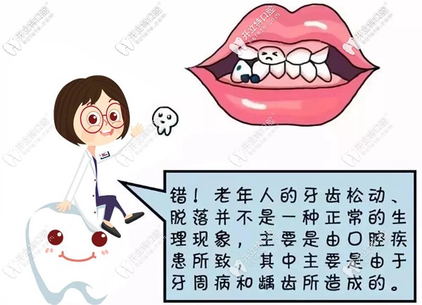 50歲全口牙松動，做即拔即種即刻負重全口種植牙吃飯香啦~