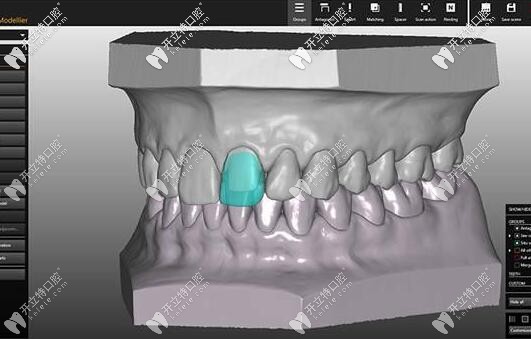 美學設計修復 美學設計修復