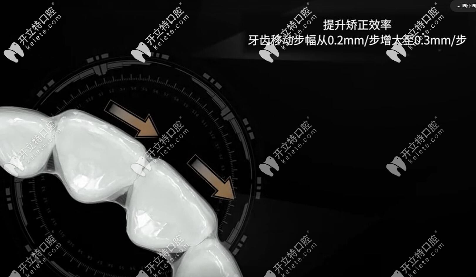 達(dá)芬奇Apo雙膜隱形牙套效果怎么樣