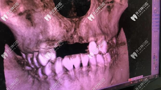 全景影像檢查可快，幾分鐘就出來