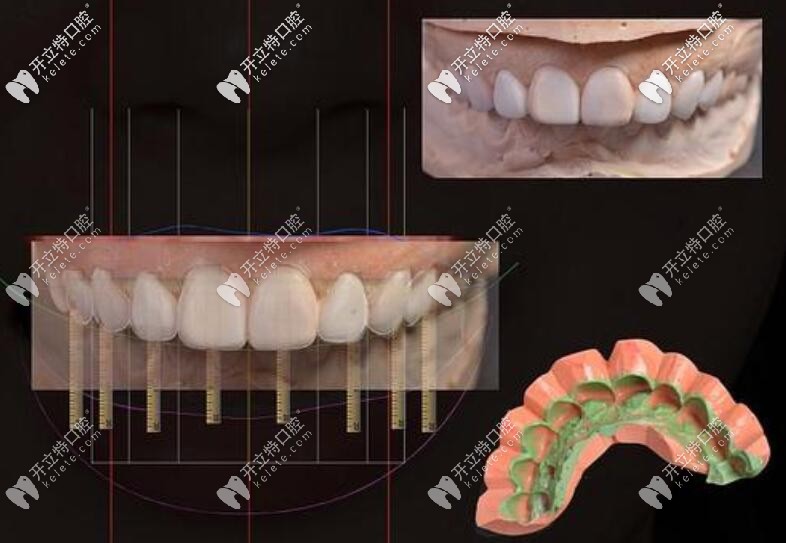 DSD美學修復 DSD美學修復
