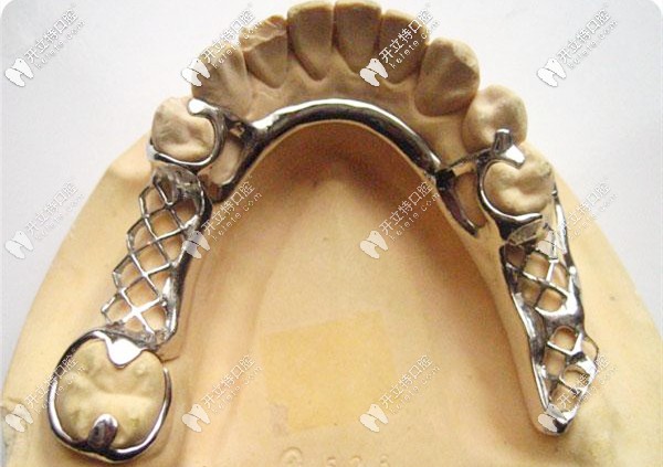 簡單分析下-美國進口的諾必靈支架和純鈦支架哪個好？