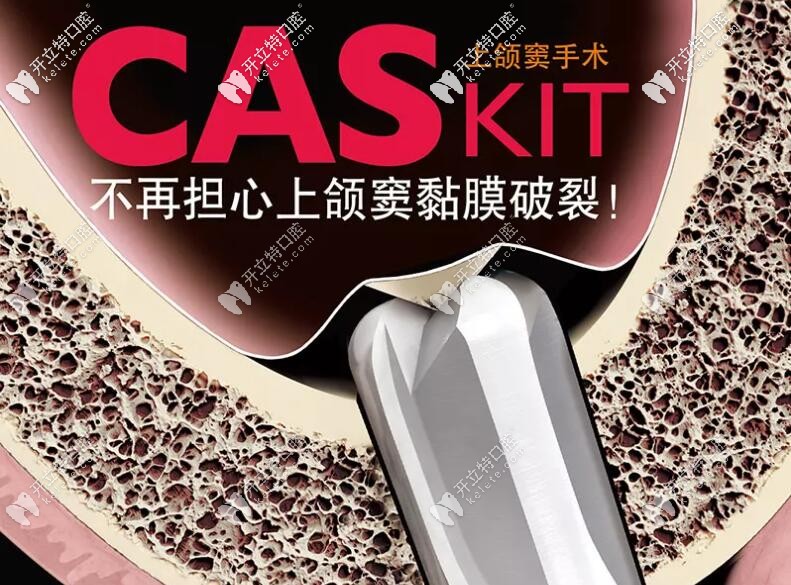 上頜竇內(nèi)外提升術(shù)