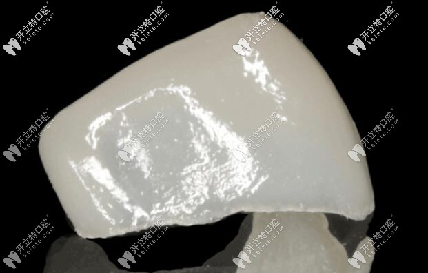 前牙修復(fù) 前牙修復(fù)