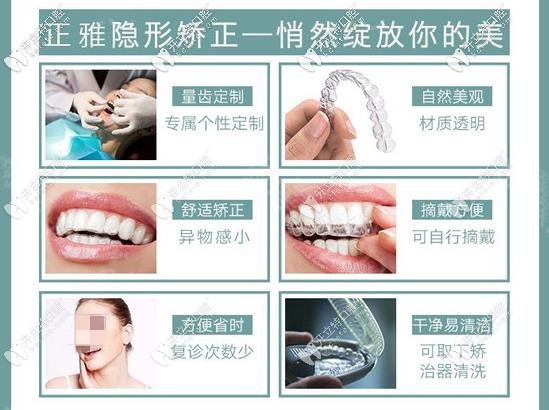 長沙德韓牙科—正雅隱形牙套優(yōu)勢(shì)