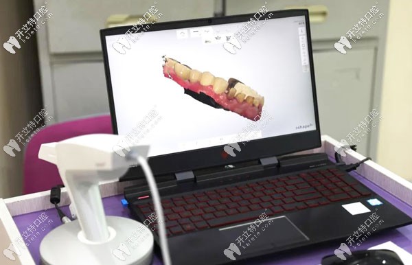 <!--<i data=20240703-sp></i>-->歐美潔口腔有自己的義齒加工中心 <!--<i data=20240703-sp></i>-->歐美潔口腔有自己的義齒加工中心