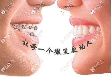矯正讓牙齒更動人