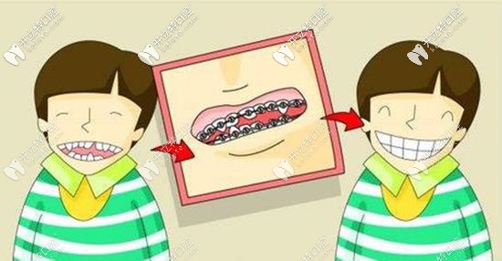 惠州致美口腔做牙齒矯正的費(fèi)用