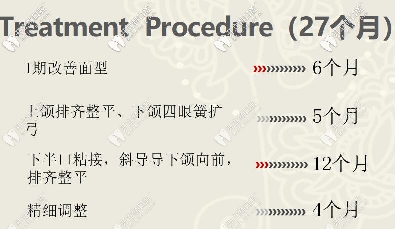 圣貝牙科深復(fù)蓋矯治案例