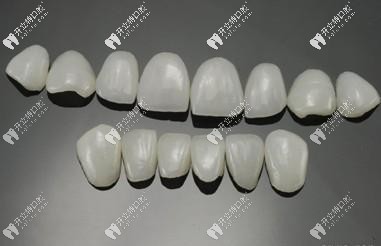 牙齒瓷貼面中的琥珀瓷和藍瓷貼面區(qū)別大嗎?哪個好？