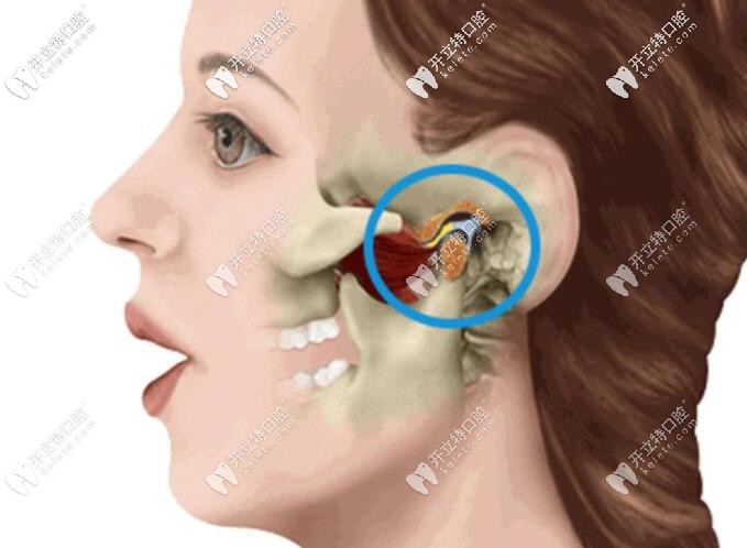 顳下頜關(guān)節(jié)紊亂會彈響