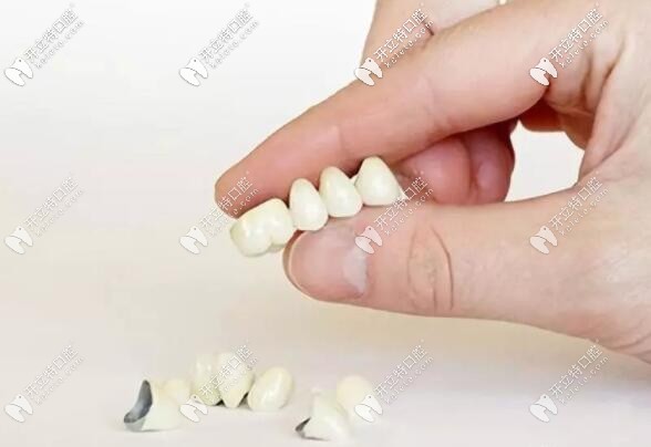 烤瓷牙冠出現(xiàn)牙齦黑線的修復方法