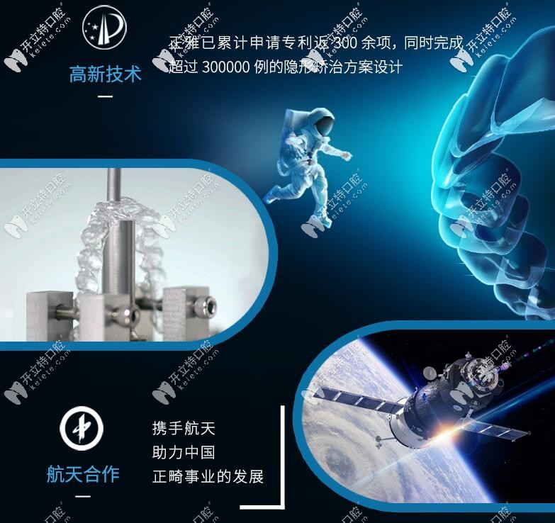 國(guó)產(chǎn)正雅牙套是航天局合作伙伴