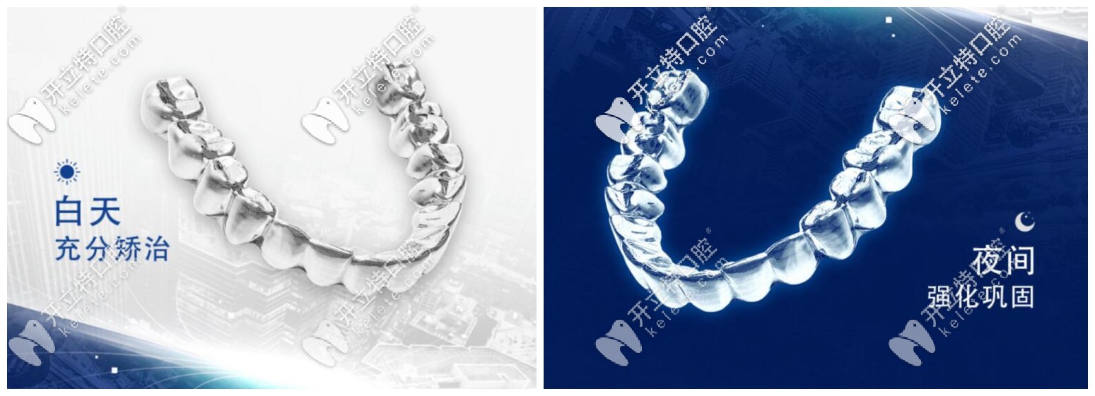 正雅日夜版雙膜隱形牙套效果怎么樣？入手價(jià)格大概是多少