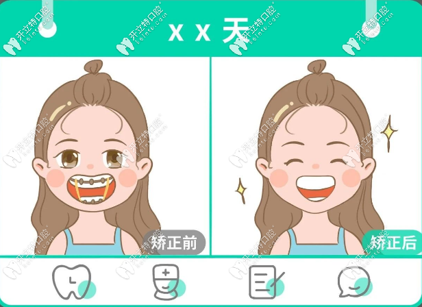 在揭陽(yáng)做牙齒矯正的價(jià)格