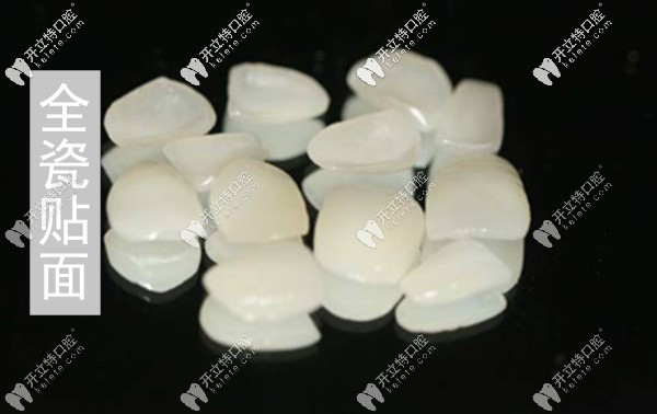 合肥貝杰口腔全瓷貼面修復(fù)的價格