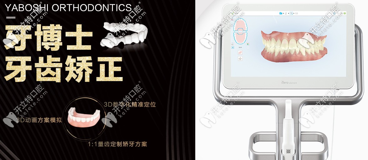 重慶牙博士矯正優(yōu)勢