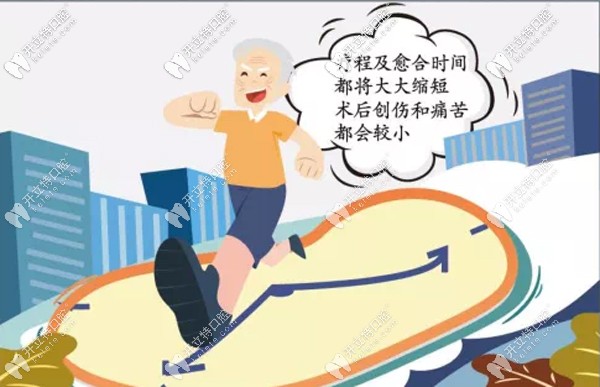 湖州鼎植種植牙愈合時間短