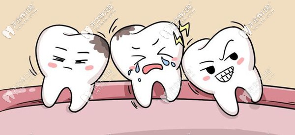 廈門登特口腔拔智齒多少錢？想知道登特和公立醫(yī)院比貴么