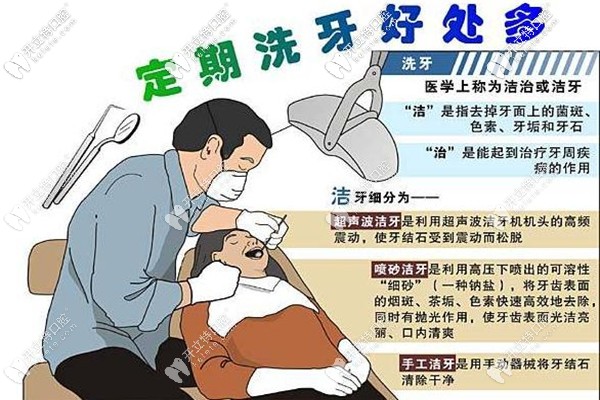 達(dá)州正規(guī)牙科醫(yī)院洗牙一般多少錢一次,收費(fèi)價(jià)格你拿去