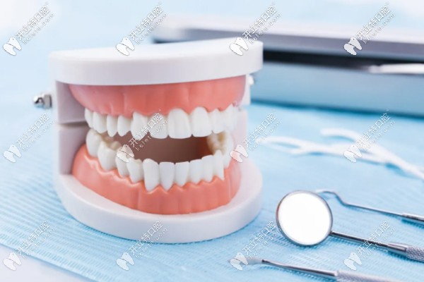 全口種植牙上下6顆種植體的價格