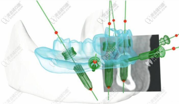 當(dāng)天種當(dāng)天用技術(shù) 當(dāng)天種當(dāng)天用技術(shù)
