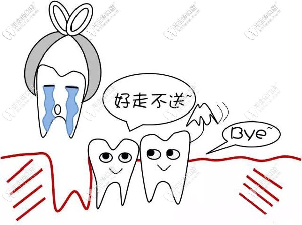 智齒不疼時就要拔除哦