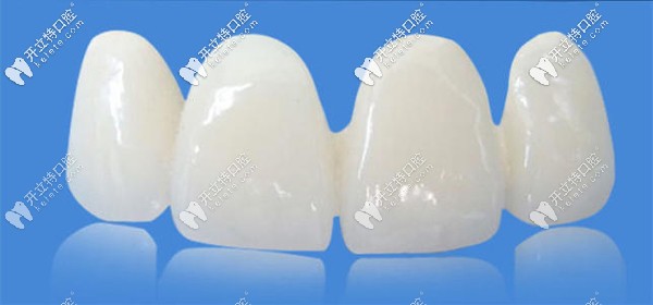 國(guó)產(chǎn)美晶瓷PK愛(ài)爾創(chuàng)全瓷牙哪個(gè)好？來(lái)看價(jià)格及優(yōu)缺點(diǎn)~