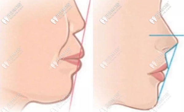 選擇置略馬瀧齒科做正畸的原因