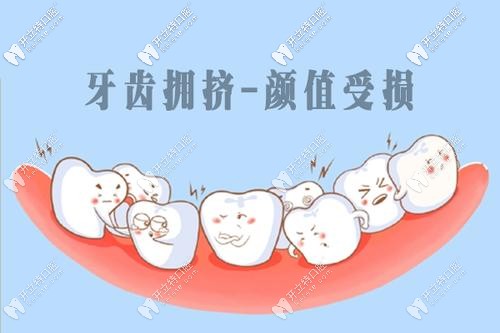 牙齒擁擠影響顏值