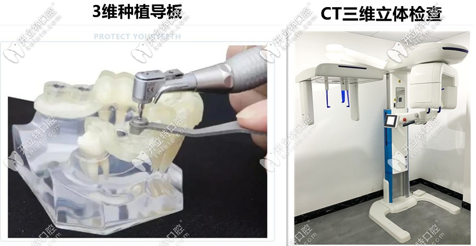 益陽德益口腔—先進(jìn)數(shù)字化設(shè)備