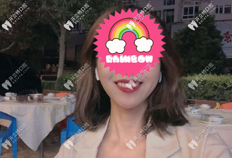 牙齒矯正后圖片 牙齒矯正后圖片