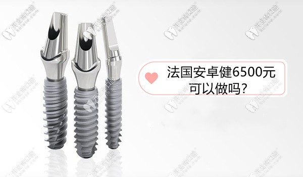 法國安卓健種植牙價格6500元可以做嗎?屬中端檔次性價比高