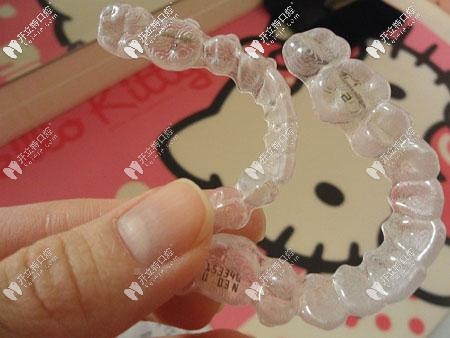 隱適美矯治技術(shù)