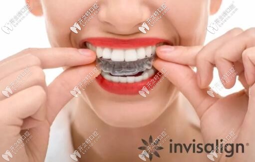 隱適美是按副算錢的嗎?價格和牙套數(shù)量有關(guān)嗎