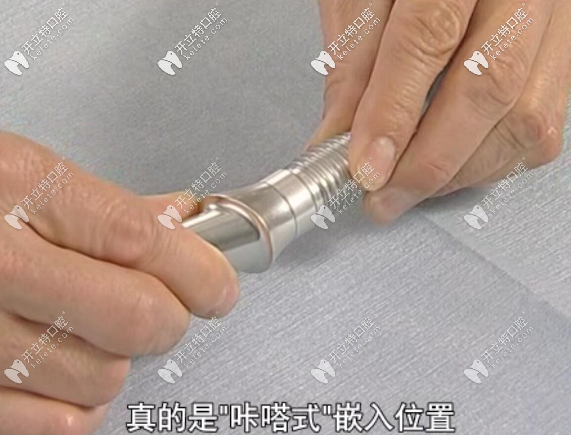 植體和基臺連接演示