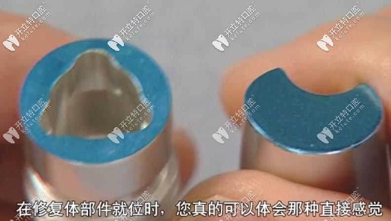 植體和基臺沒有結(jié)合前的圖片