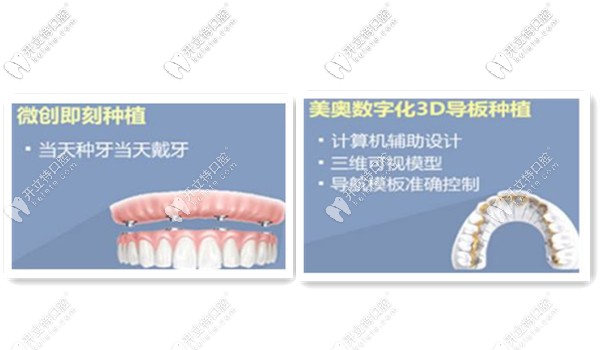 無錫美奧口腔醫(yī)院種植牙技術(shù)