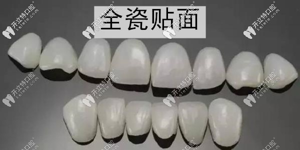 廣州柏德口腔牙齒貼面多少錢