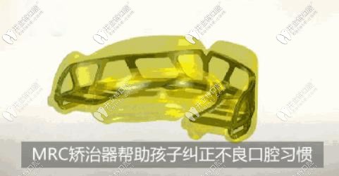 MRC肌功能矯治器：有效幫助孩子矯正不良口腔習(xí)慣