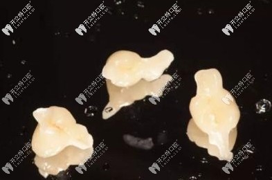 很少有人做馬里蘭橋義齒修復技術