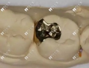 醫(yī)生技術(shù)不豐富，材料填充不嚴(yán)密